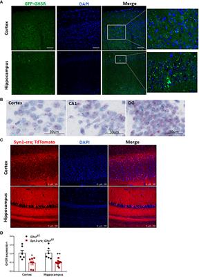 Neuronal ablation of GHSR mitigates diet-induced depression and memory impairment via AMPK-autophagy signaling-mediated inflammation